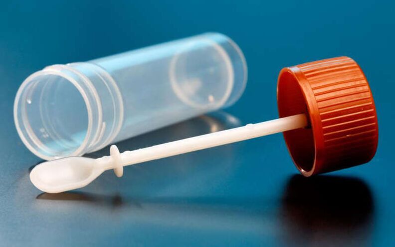 Тест за изпражнения за червеи