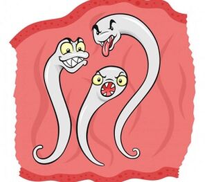 какви паразити могат да живеят в човешкото тяло