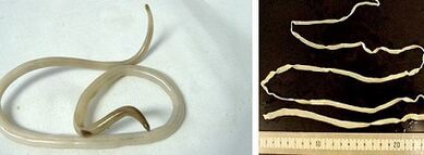 Видове паразити в човешкото тяло