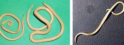 какви паразити може да има човек